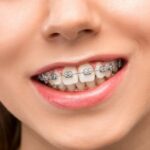 dental hygienist Orthodontics