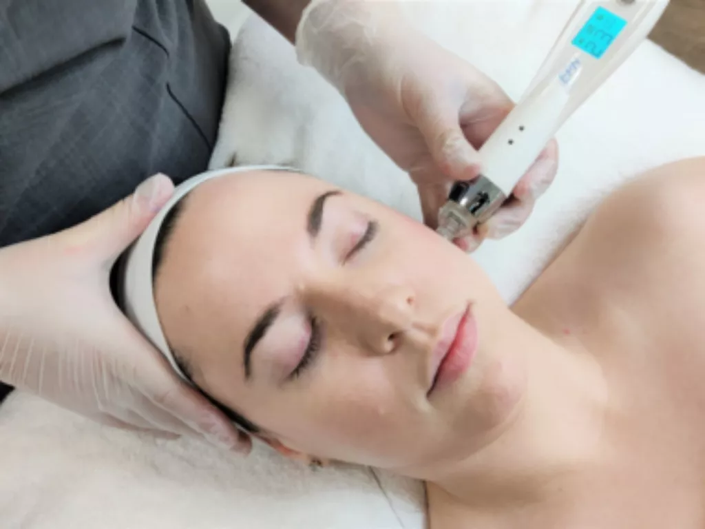 How to Properly Care for Your Skin After Mesotherapy Treatment?