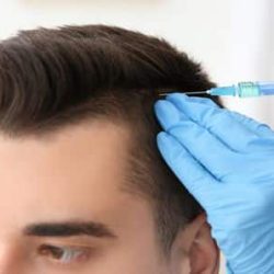 علاج تساقط الشعر