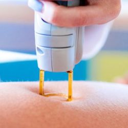 BEST LASER HAIR REMOVAL DUBAI ​