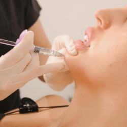 Cheek Filler