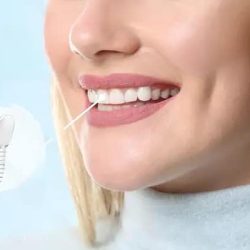 How Long Do Dental Implants Last?