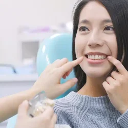 Full Mouth REHABILITATION by Lavish Clinic